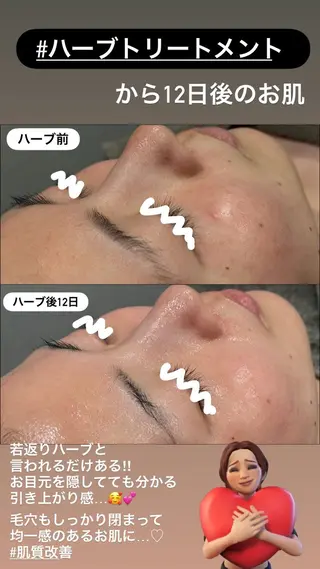 LiZA エステティックサロンのエステ・リラクイメージ