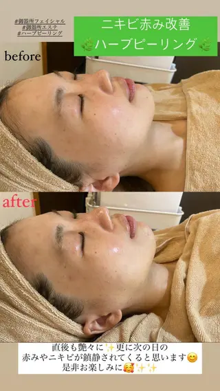 Salon de Lino 御器所のエステ・リラクイメージ