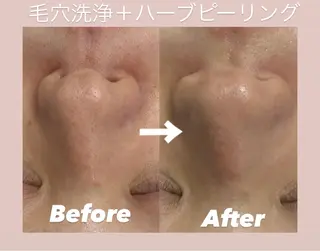韓国肌管理 Belle堀江のエステ・リラクイメージ