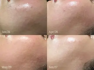 lymph care 'Welnəsのエステ・リラクイメージ