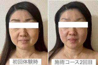 小顔サロン (ラ リュミエール)のエステ・リラクイメージ