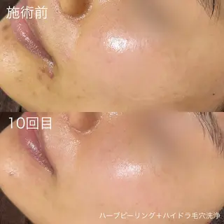 lulula ricoのエステ・リラクイメージ