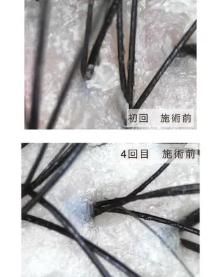 中畑 莉菜のヘアスタイル