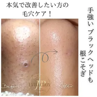 川口 春奈のエステ・リラクイメージ