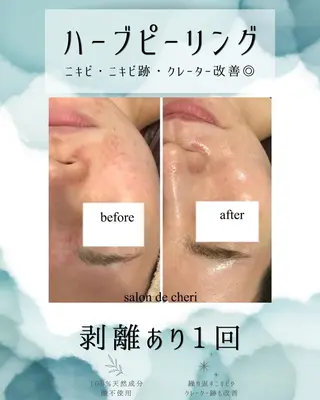 医療提携 肌管理痩身エステ池袋のエステ・リラクイメージ
