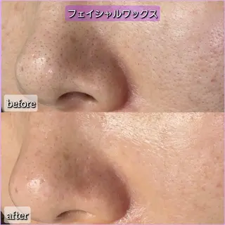salon Lilyのエステ・リラクイメージ