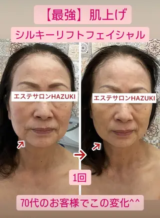 たるみ改善小顔エステ 堀葉月のその他イメージ