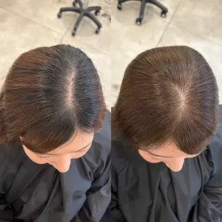 ⭐️生えぐせ改善 ヘアリセッター✂️のヘアスタイル
