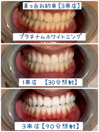 セルフホワイトニング メーカー直営サロンのエステ・リラクイメージ