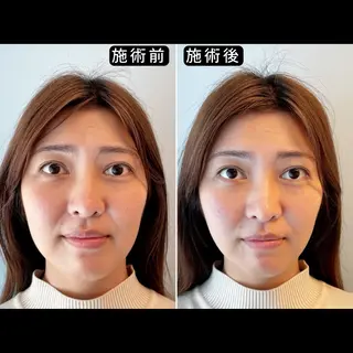 渋谷 美容鍼 首肩こり YZ先生のエステ・リラクイメージ