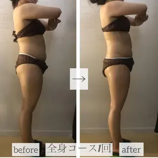 小顔.足痩せ整体 痩身天六Sunaoのエステ・リラクイメージ