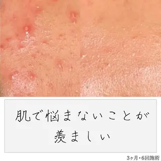 ニキビ経験者が施術 する専門サロン🌻のエステ・リラクイメージ