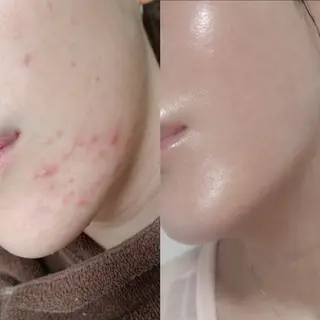 艶肌デトックス🫧 Samiraのエステ・リラクイメージ