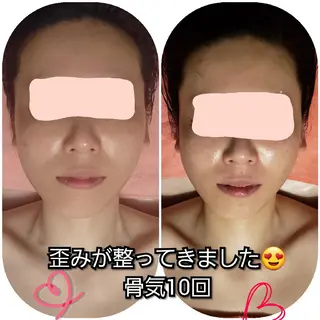 たるみ・ くすみ シミ・ニキビ肌改善のエステ・リラクイメージ