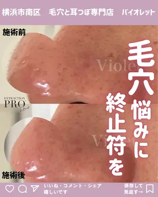 毛穴と耳つぼ専門店 バイオレット　りののその他イメージ