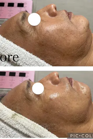 ビューティーサロン B.glossyのネイルデザイン