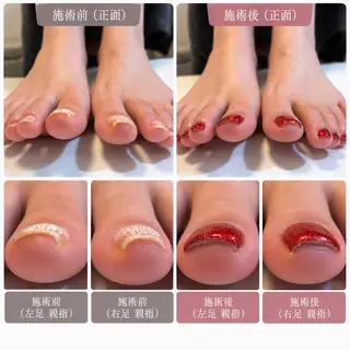 ネイル ネイルサロン💎 Bibiのネイルデザイン