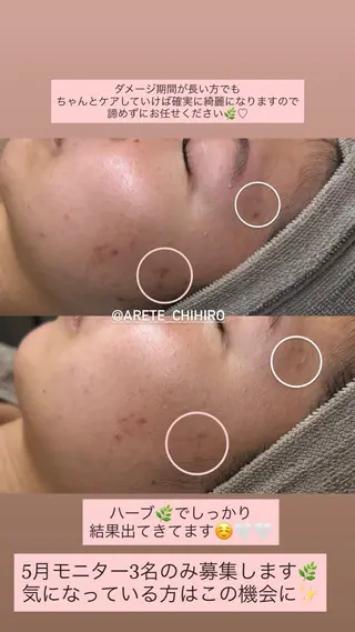salon aretéのエステ・リラクイメージ