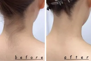 Hair Peace 脱毛サロンのエステ・リラクイメージ