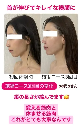 小顔サロン (ラ リュミエール)のエステ・リラクイメージ