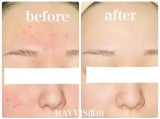 RAYVIS 郡山店 小野のエステ・リラクイメージ