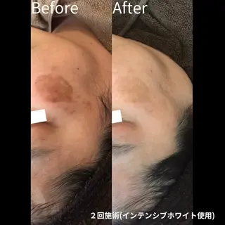 お手入れ眉/小顔 /プライベートサロンのエステ・リラクイメージ