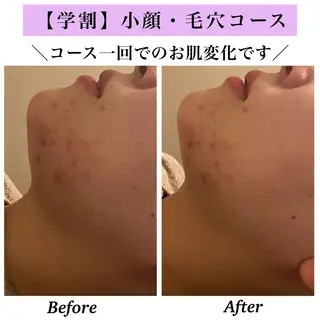 Bellesthe (ベルエステ)のエステ・リラクイメージ
