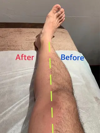 メンズ 男性施術者による 光脱毛×ワックス脱毛のエステ・リラクイメージ
