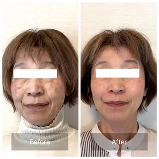 小顔・歪み専門 井元 朋子のエステ・リラクイメージ