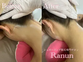 マツエク・マツパ シュガーリング脱毛 専門店Ranunのエステ・リラクイメージ