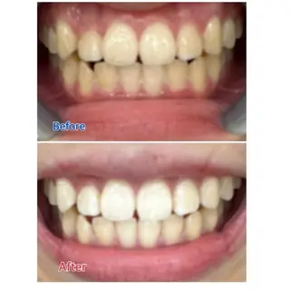 M渋谷 セルフホワイトニングのエステ・リラクイメージ