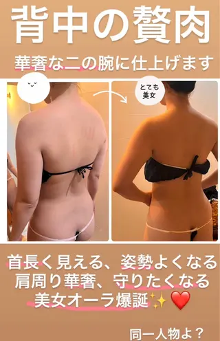切らない脂肪吸引🔥 Neroliまりこのエステ・リラクイメージ