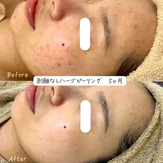 肌質改善サロン renew/ウエキのエステ・リラクイメージ