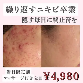 ニキビ・肌質改善専門 ♡人生が変わるサロンのエステ・リラクイメージ