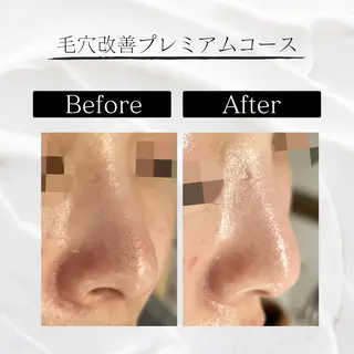 NAYU/レディース 眉毛/堺筋本町の眉毛・アイブロウイメージ