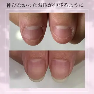 ネイル 雀宮 自爪育成 Re.nail〜寺本のネイルデザイン