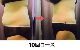 横浜エステサロン R-ing リングのエステ・リラクイメージ