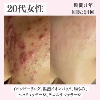 ニキビ・肌質改善専門 ♡人生が変わるサロンのエステ・リラクイメージ