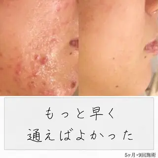 ニキビ経験者が施術 する専門サロン🌻のエステ・リラクイメージ