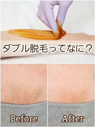 A*《エースター》 シュガーリング🍋のエステ・リラクイメージ