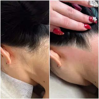 オンダリフト小顔・ ワックス脱毛×光脱毛のエステ・リラクイメージ