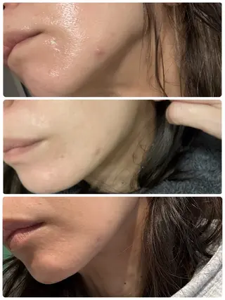 yellow💛【 脱毛&フェイシャル】のエステ・リラクイメージ