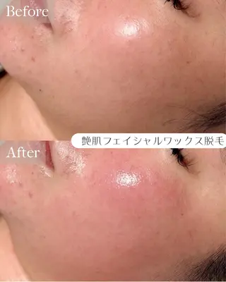 ルコル池袋【毛穴洗浄 /wax顔脱毛】えみのエステ・リラクイメージ