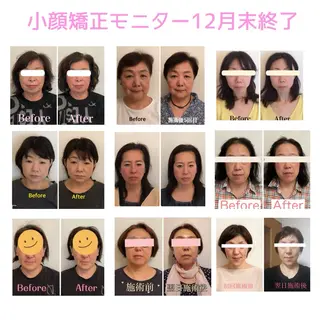 町田・鶴川 小顔矯正 /鈴木友実のエステ・リラクイメージ
