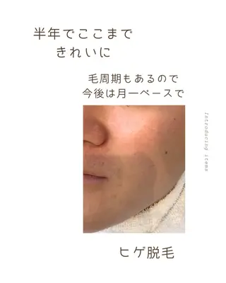 𓇼.⋆ 𓆉 ˖* shou shouのマツエク・マツパデザイン