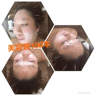 美容鍼灸イロドリ のエステ・リラクイメージ