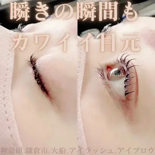 マツエク・マツパ ハーブピーリング /KAEDEのエステ・リラクイメージ