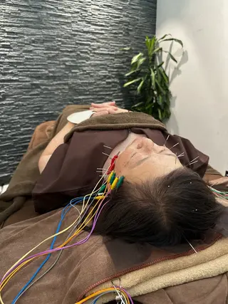 小顔矯/美容鍼/鍼灸 BeauJuのその他イメージ