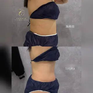 心斎橋🤍堀江.小顔 ハーブ.痩身クレビアのエステ・リラクイメージ