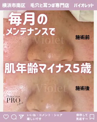 毛穴と耳つぼ専門店 バイオレット　りののその他イメージ